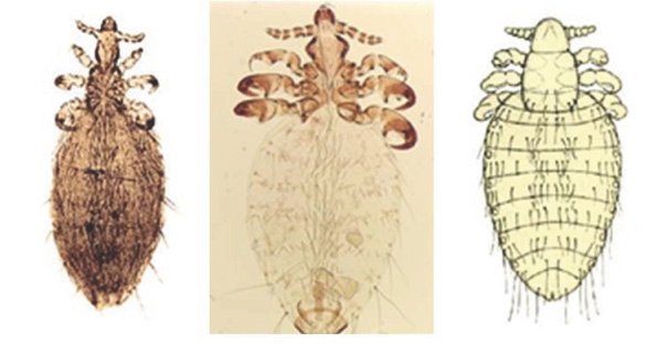 Goat lice